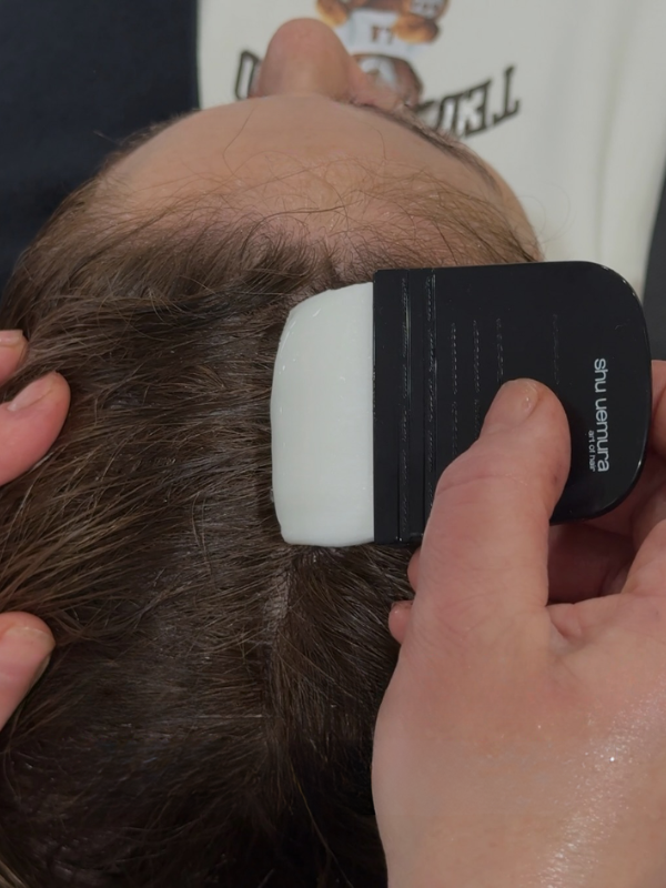 Trattamenti Capelli